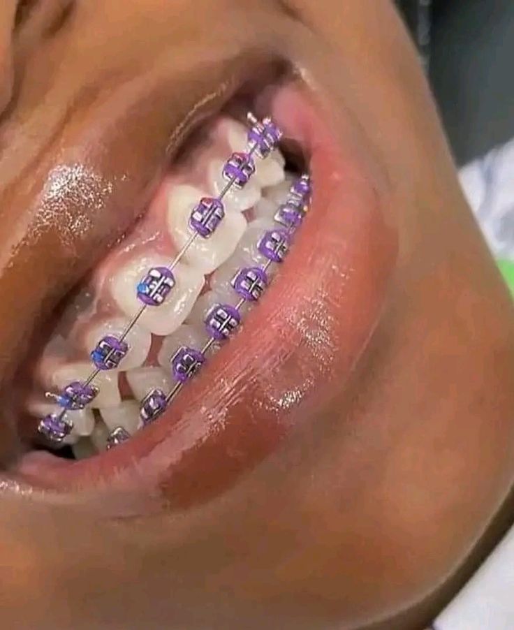 Orthodontics Kampala